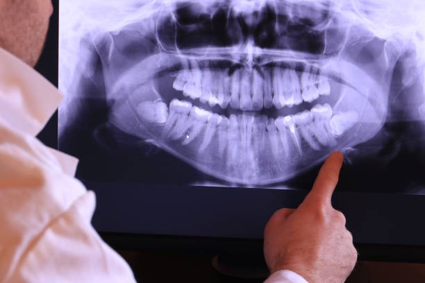 Best Emergency Treatment for Toothache in Lennox, SD